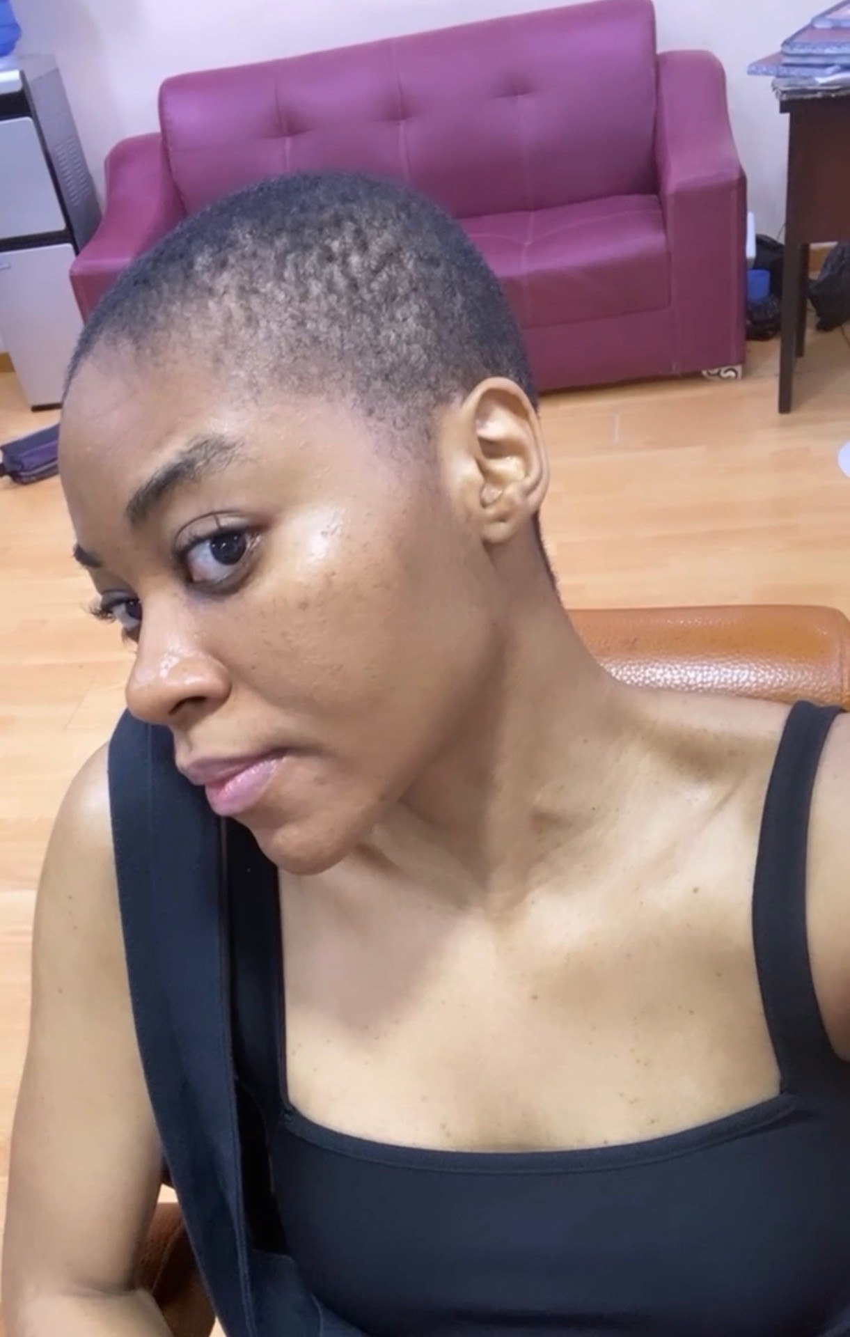 Daisy with a buzz cut after losing her hair